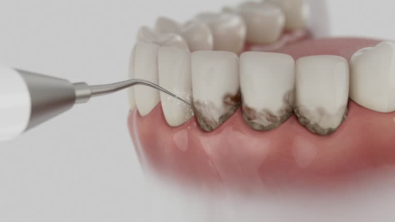 Reliable Teeth Cleaning And Checkup contractor in Bolivar County County, MS by Dentist Open Now
